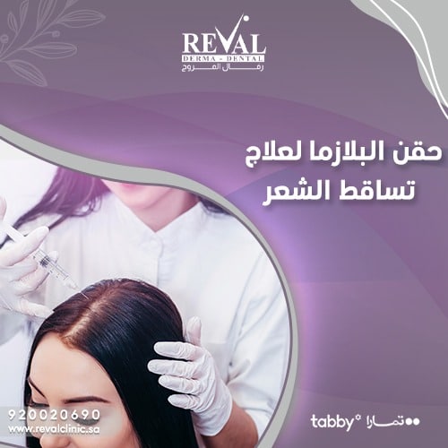 فوائد حقن البلازما لعلاج الصلع الوراثي وتساقط الشعر
