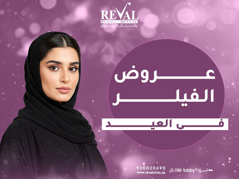 عروض الفيلر في العيد