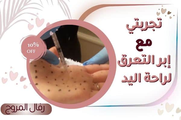 تجربتي مع بوتكس فرط التعرق لليدين