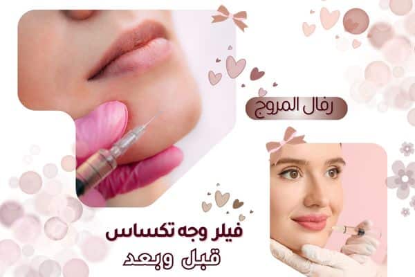 تكساس وجه قبل وبعد
