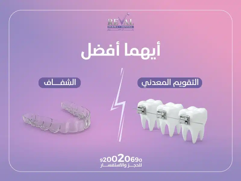 كيف تختار أفضل أنواع تقويم الأسنان؟