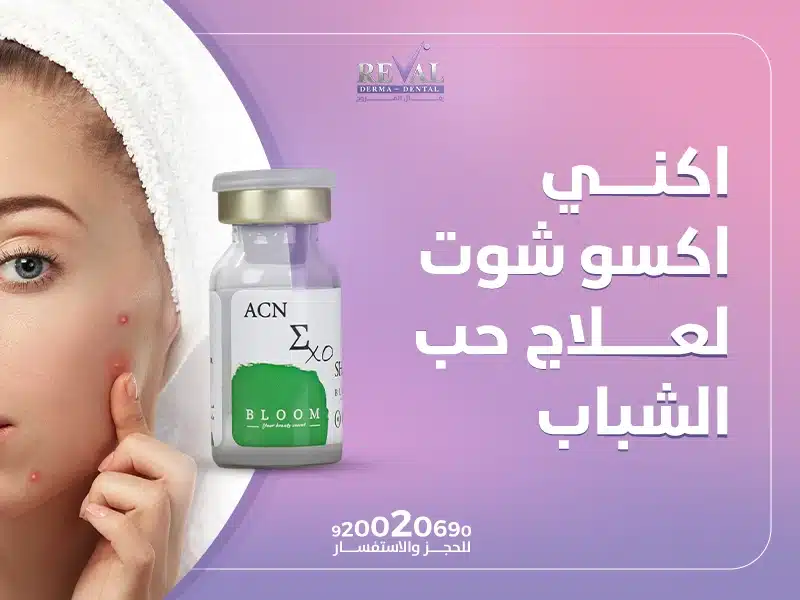 تجربتي مع اكني اكسو شوت