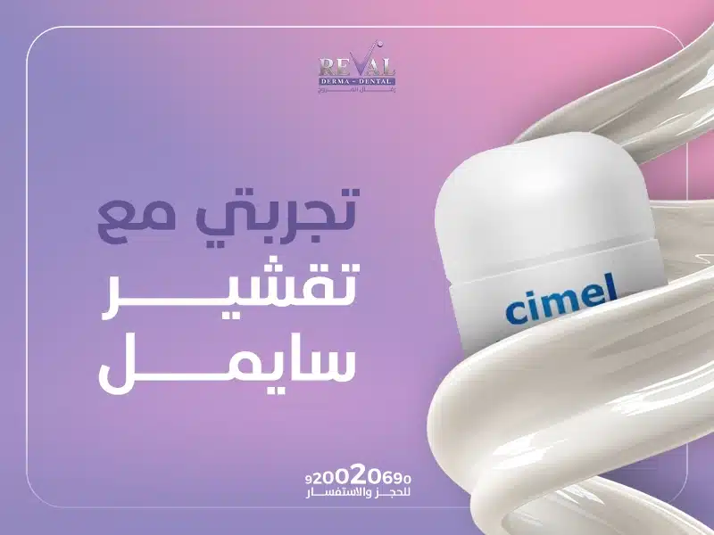 تجربتي مع تقشير سيميل البارد لتفتيح وتجديد البشرة في الرياض