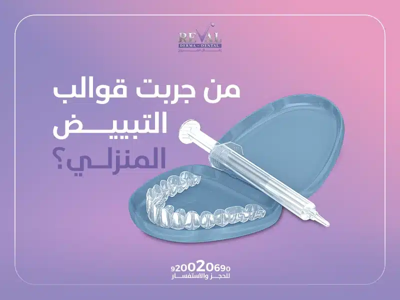 من جربت قوالب التبييض المنزلي ⁉️ متى تظهر نتيجة تبييض الأسنان بالقوالب؟