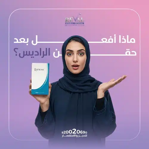 تجربتي مادة الراديس