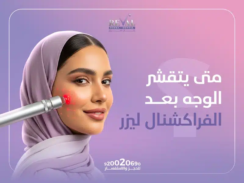 متى يتقشر الوجه بعد الفراكشنال ليزر؟ شكل البشره بعد الفراكشنال ليزر؟