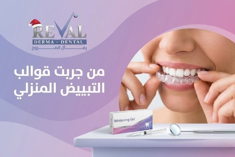 من جربت قوالب التبييض المنزلي