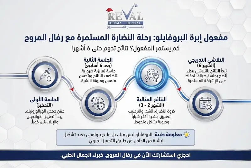كم يستمر مفعول ابرة البروفايلو؟