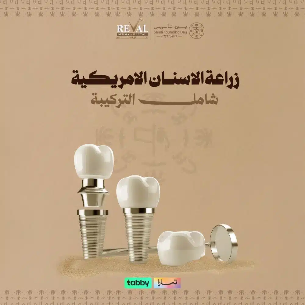 عروض زراعة الأسنان الأمريكية شاملة التركيبة في يوم التأسيس