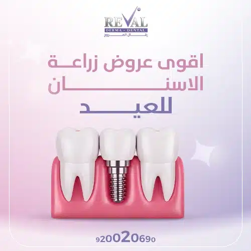 اقوي عروض الاسنان