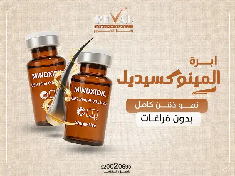ما هو المينوكسيديل؟