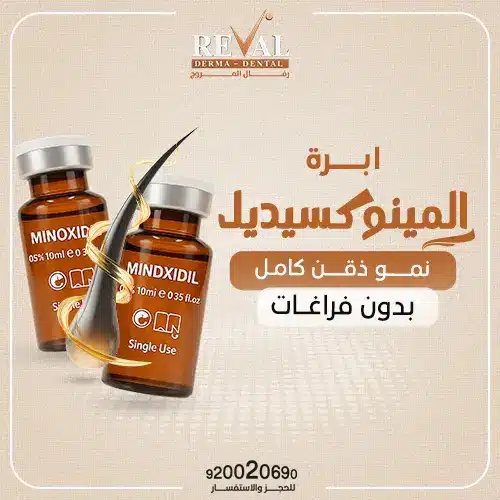 تجربتي مع المينوكسيديل