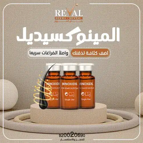 متى تظهر نتائج المينوكسيديل؟