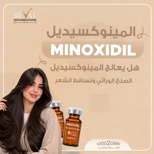 فوائد المينوكسيديل