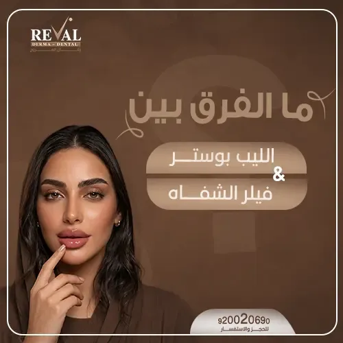 تجربتي مع الليب بوستر