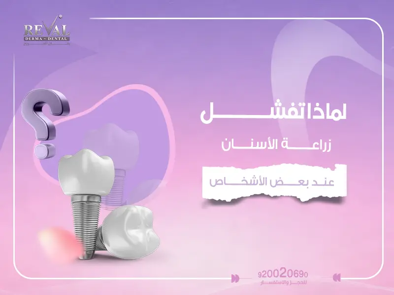 لماذا تفشل زراعة الأسنان عند بعض الأشخاص؟ الأسباب وطرق تجنبها في الرياض