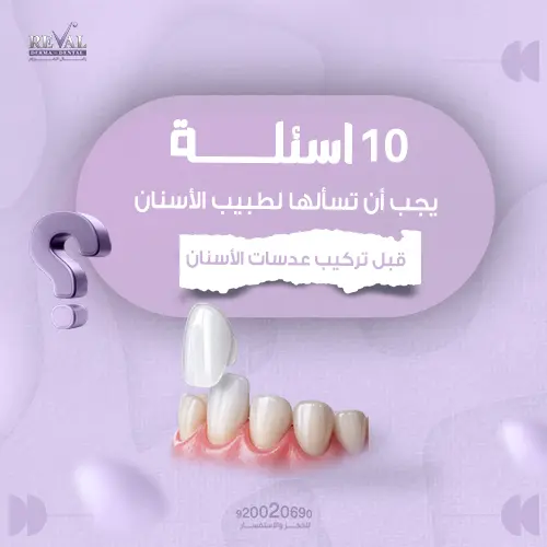 أسئلة يجب أن تسألها لطبيب الأسنان قبل تركيب عدسات الأسنان