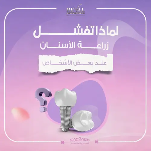 ما أسباب فشل زراعة الأسنان