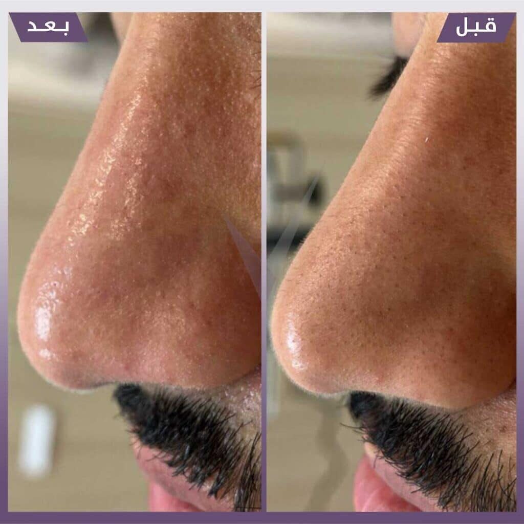 تنظيف بشرة هايدرافيشال