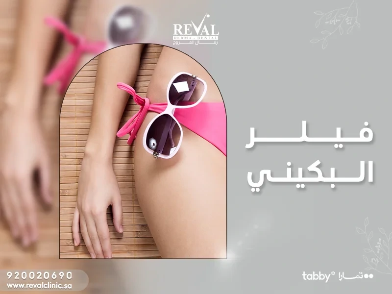 فيلر البكيني bikini-filler-أسرار تجربتي مع تفتيح بين الفخذين