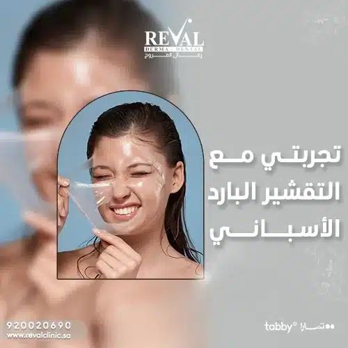 تجربتي مع التقشير البارد الأسباني spanish-cold-peeling-treatment