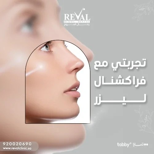 تجربتي مع جلسة فراكشنال ليزر Fractional laser