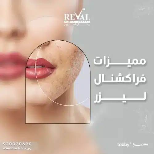 فوائد فراكشنال ليزر Fractional laser