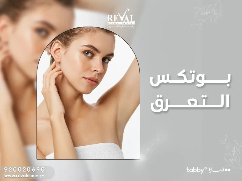 ما هو بوتكس التعرق botox-for-hyperhidrosis