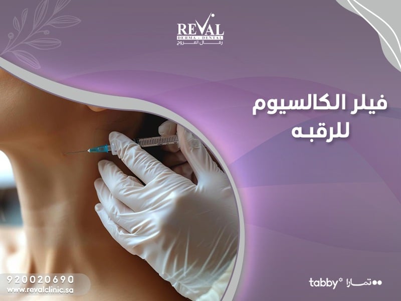 فيلر الكالسيوم للرقبة