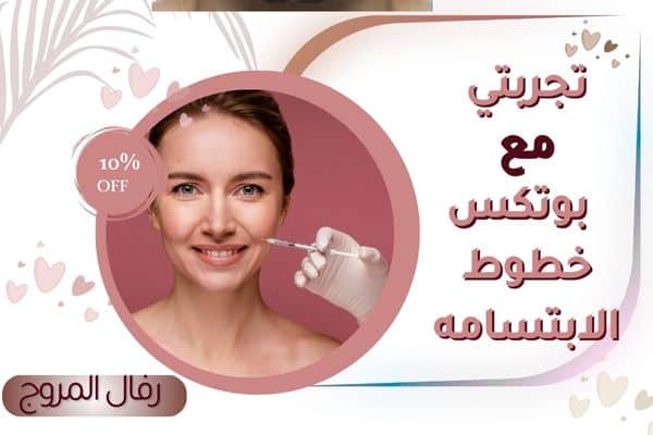 تجربتي مع بوتكس خطوط الابتسامه