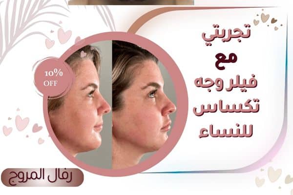 تجربتي مع فيلر الوجه التكساس للنساء