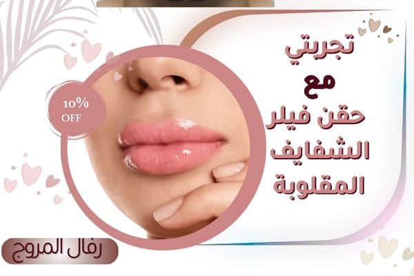 تجربتي مع فيلر الشفايف المقلوبة
