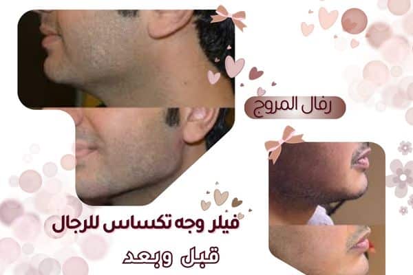 وجه تكساس للرجال قبل وبعد