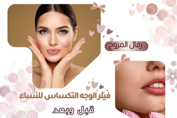 فيلر الوجه التكساس للنساء قبل وبعد