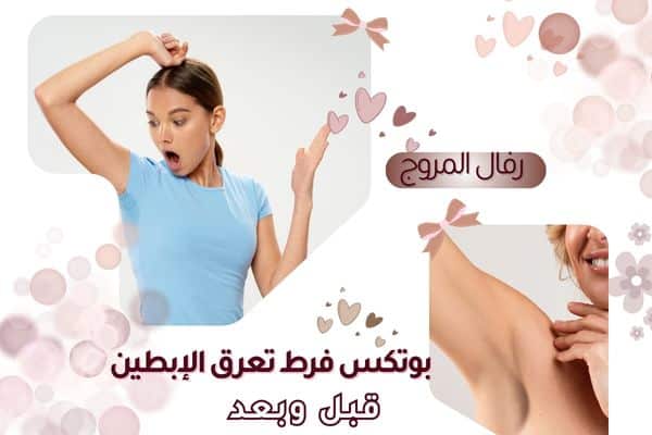 نصائح قبل وبعد جلسة بوتكس فرط تعرق الإبطين
