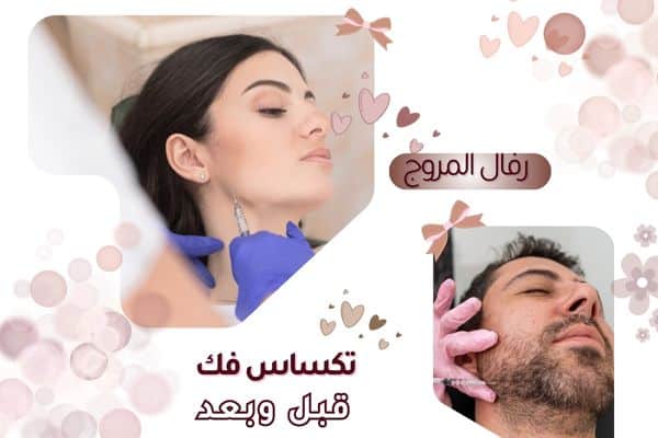 تكساس فك قبل وبعد