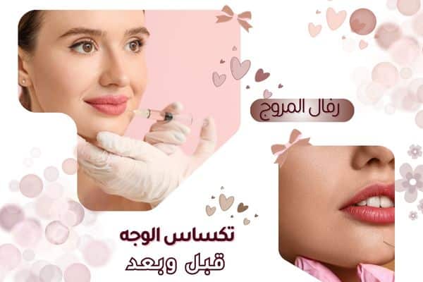 كم تدوم نتائج تكساس الوجه