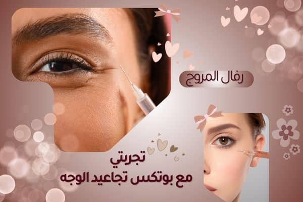 تجربتي مع حقن بوتكس تجاعيد الوجه