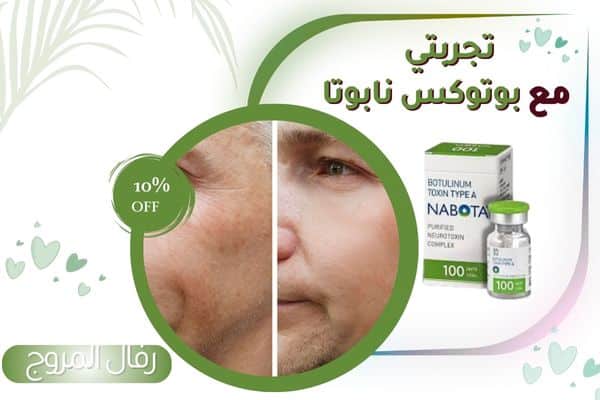 تجربتي مع حقن بوتوكس نابوتا