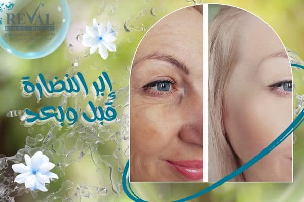 كيف تختار أفضل إبر النضارة