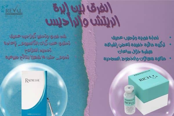  إبرة الريتش والراديس