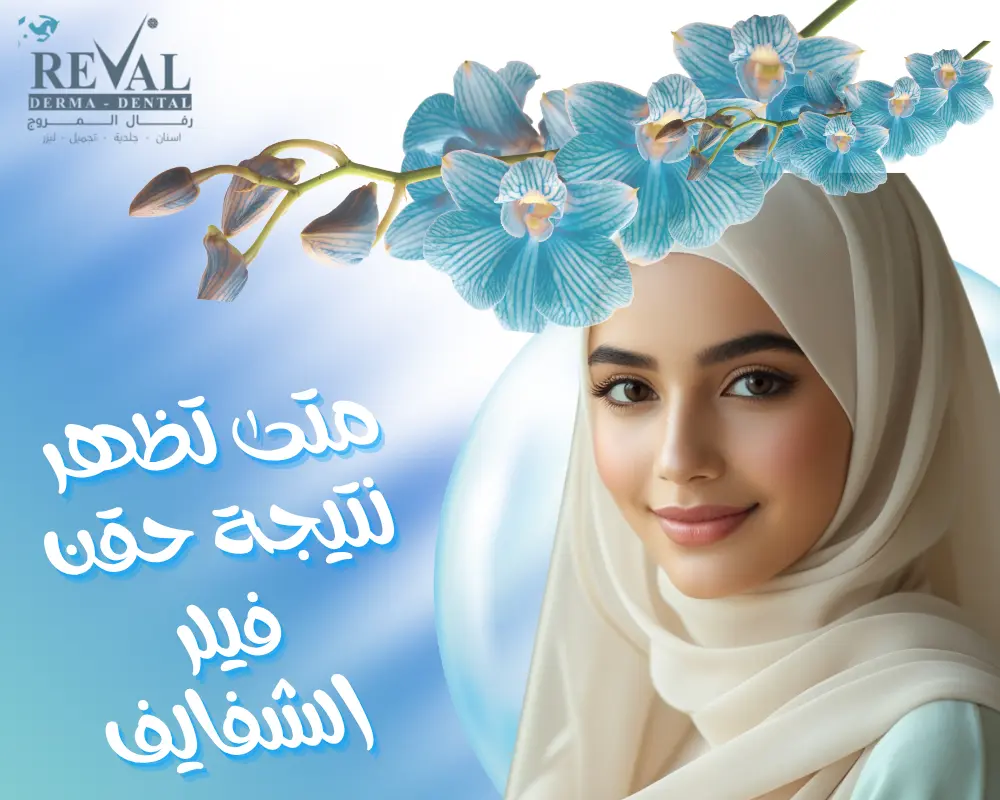 متى تظهر نتيجة حقن فيلر الشفايف؟ دليلك لنتائج فورية وطويلة الأمد