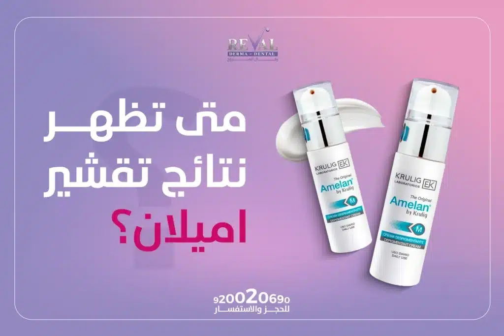 متى تظهر نتائج تقشير أميلان؟ متى ترجع البشرة لطبيعتها بعد التقشير البارد⁉️