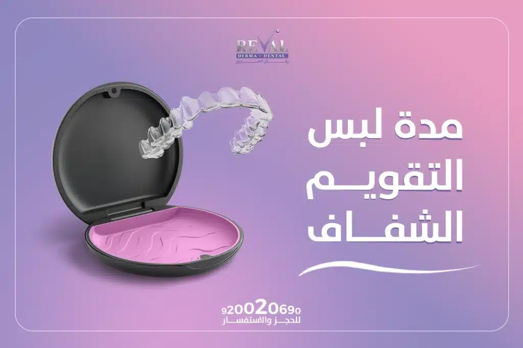 مدة لبس التقويم الشفاف | كم تدوم تقويمات الأسنان الشفافة؟ 