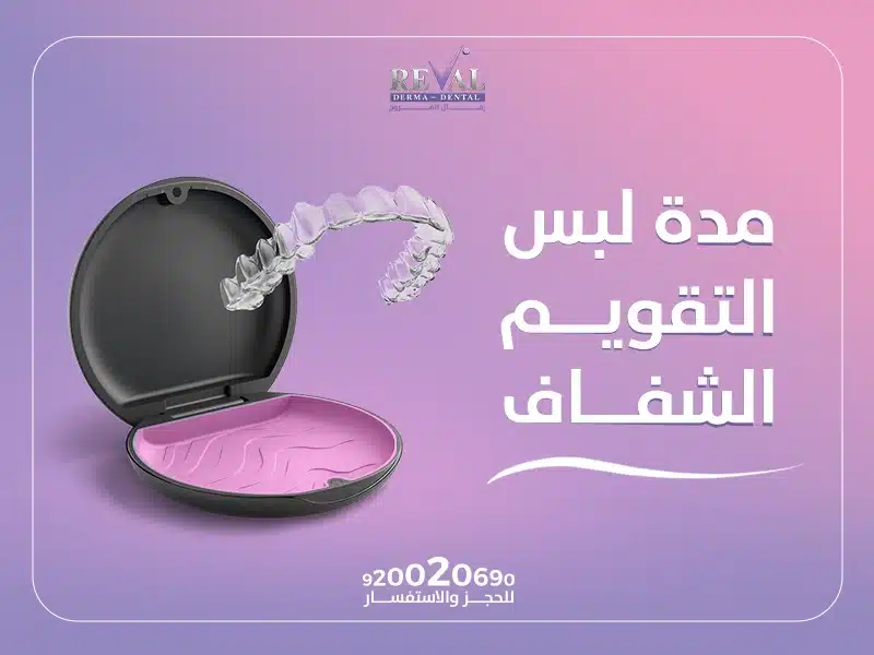 كم تدوم تقويمات الأسنان الشفافة؟