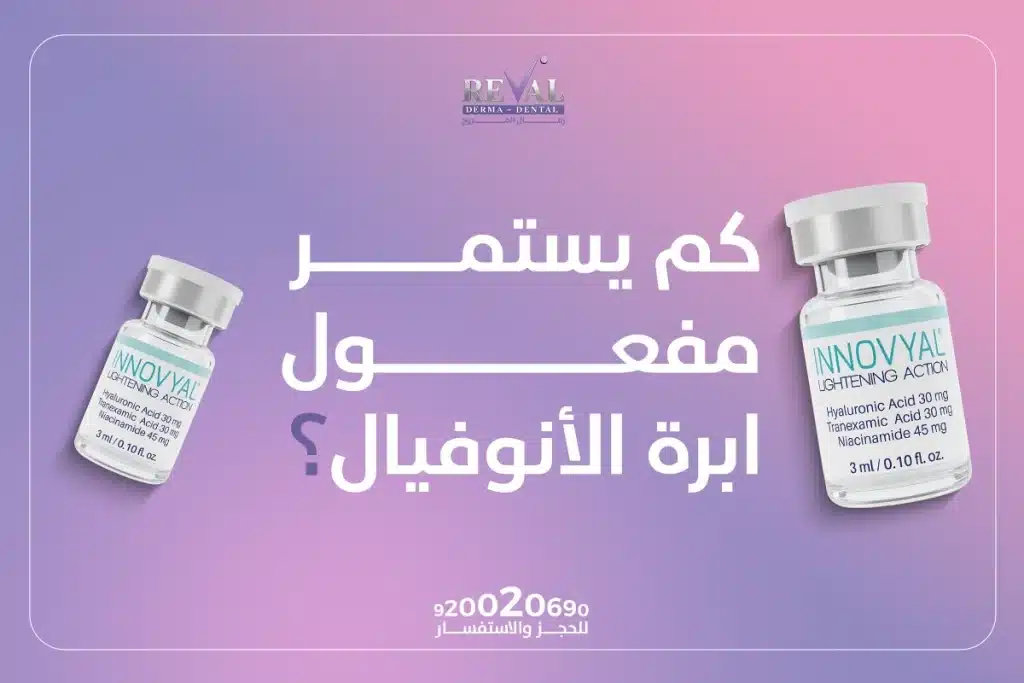 كم يستمر مفعول إبرة الأنوفيال؟ هل الأنوفيال فيلر؟ 