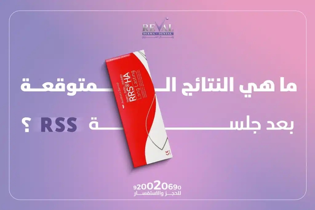 ما هي النتائج المتوقعة بعد جلسة RRS؟ ما هي إبرة النضارة RRS؟