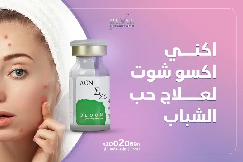 اكني اكسو شوت لعلاج حب الشباب | كيف أجعل وجهي صافي من حب الشباب؟