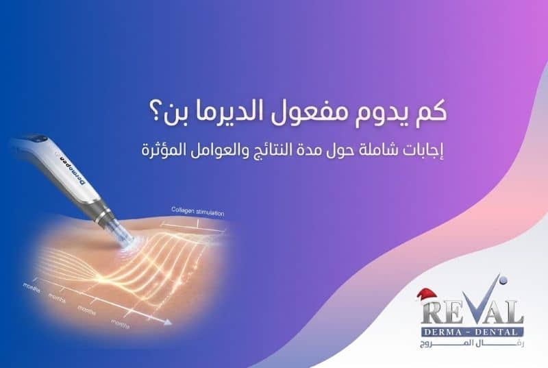 كم يدوم مفعول الديرما بن؟ كم عدد جلسات ديرمابن التي يحتاجها الوجه؟