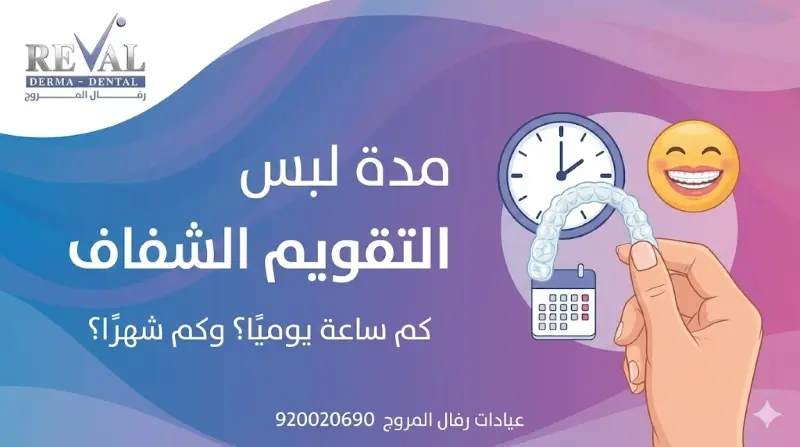 مدة لبس التقويم الشفاف | كم تدوم تقويمات الأسنان الشفافة؟ 